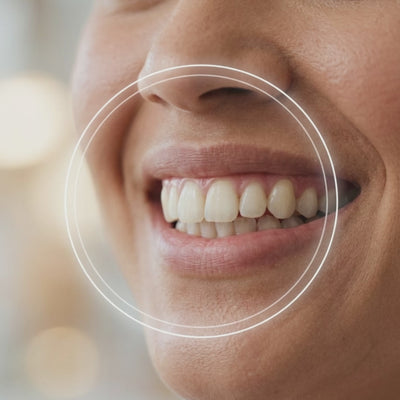 UniqueSmile® Probiotics